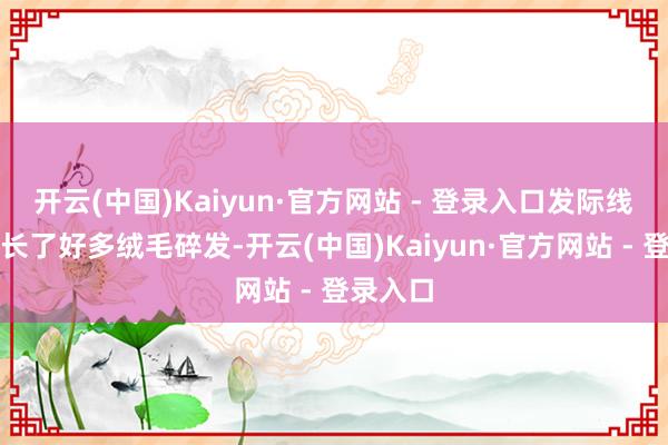 开云(中国)Kaiyun·官方网站 - 登录入口发际线和头顶长了好多绒毛碎发-开云(中国)Kaiyun·官方网站 - 登录入口